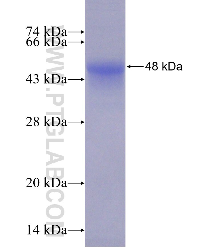 spike protein fusion protein Ag31496 SDS-PAGE