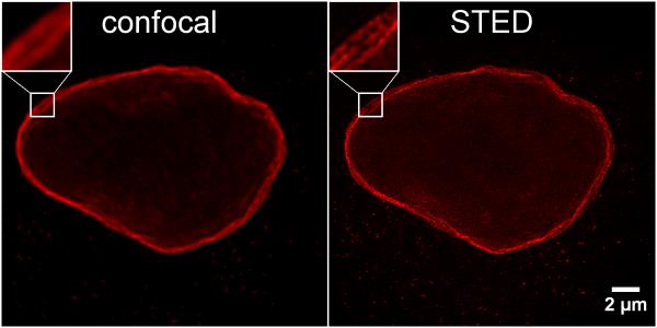 HeLa cells were immunostained with rabbit anti-Lamin B1 antibodies and alpaca anti-rabbit IgG VHH Alexa Fluor® 568 (1:1,000). Confocal and gated STED images were acquired with a Leica TCS SP8 STED 3X microscope, pulsed depletion with a 775 nm laser. Images were recorded at the Core Facility Bioimaging at the Biomedical Center, LMU Munich.