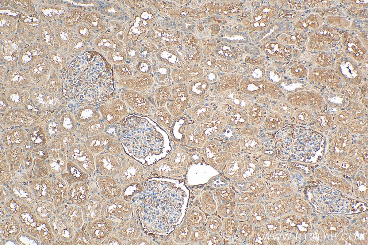 Immunohistochemistry (IHC) staining of human kidney tissue using Biotin-conjugated tPA Polyclonal antibody (Biotin-10147)