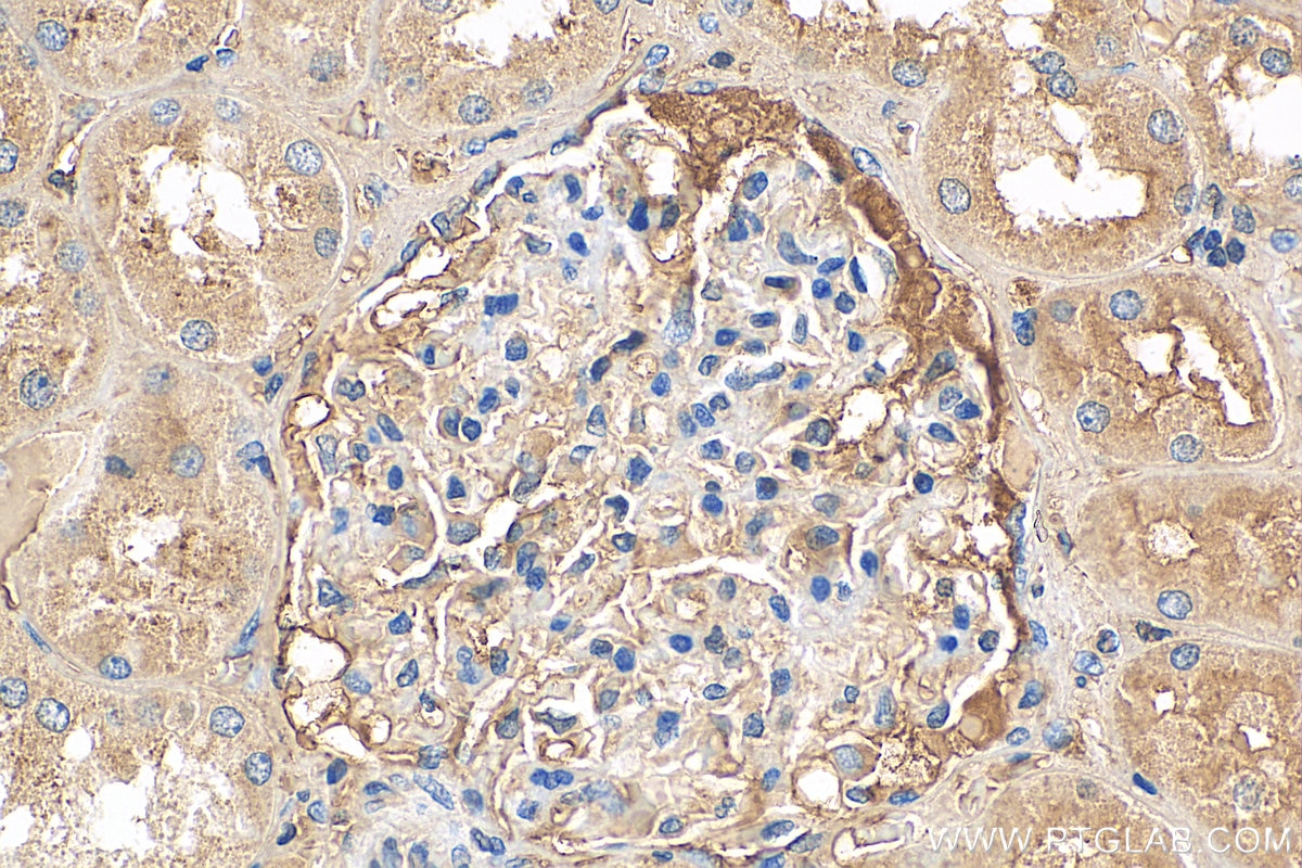 Immunohistochemistry (IHC) staining of human kidney tissue using Biotin-conjugated tPA Polyclonal antibody (Biotin-10147)