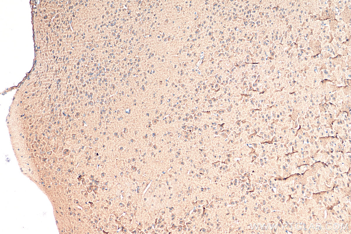 Immunohistochemistry (IHC) staining of mouse brain tissue using Biotin-conjugated tPA Polyclonal antibody (Biotin-10147)