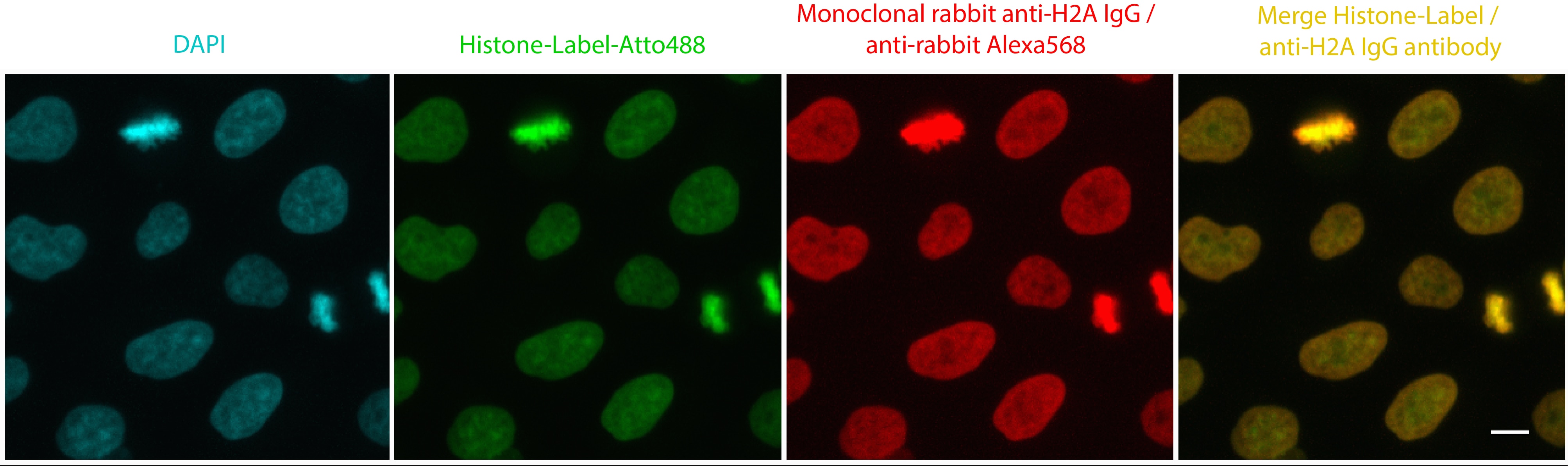 ChromoTek Histone-Label is a convenient, ready to use, and high-performing chromatin staining probe with low background levels and that differentiates between euchromatin and heterochromatin. HeLa cells stained in parallel with Histone-Label (1.25 mg/L) and a monoclonal rabbit anti-H2A IgG / anti-rabbit Alexa568 secondary antibody. Histone-Label co-localizes with conventional antibody staining, however Histone-Label better penetrates into the compactly packed nuclei than the anti-H2A IgG and secondary IgGs, which are one order of magnitude larger than the Histone-Label: see more green signal from Histone-Label at center of nuclei and more red signal from anti-H2A IgG on surface/edge of nuclei of merge image on very right.