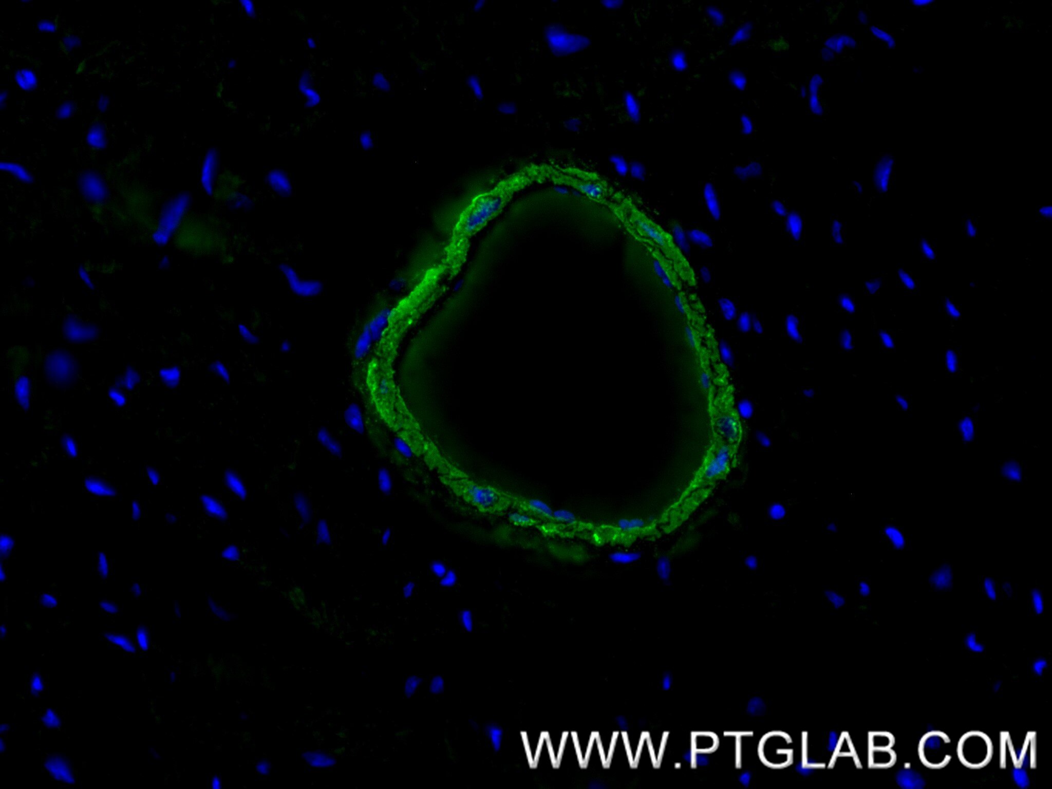 Immunofluorescence (IF) / fluorescent staining of mouse heart tissue using transgelin/SM22 Recombinant monoclonal antibody (83922-2-RR)