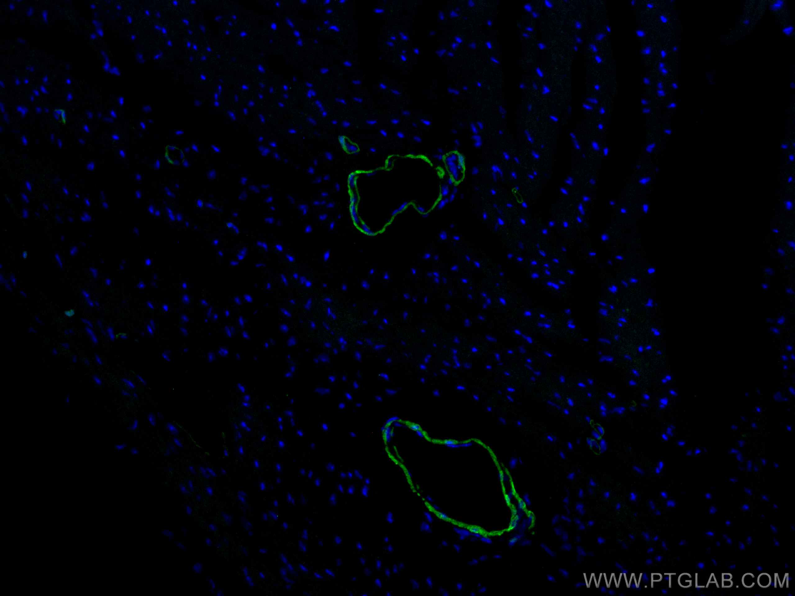 IF Staining of mouse heart using CL488-10493