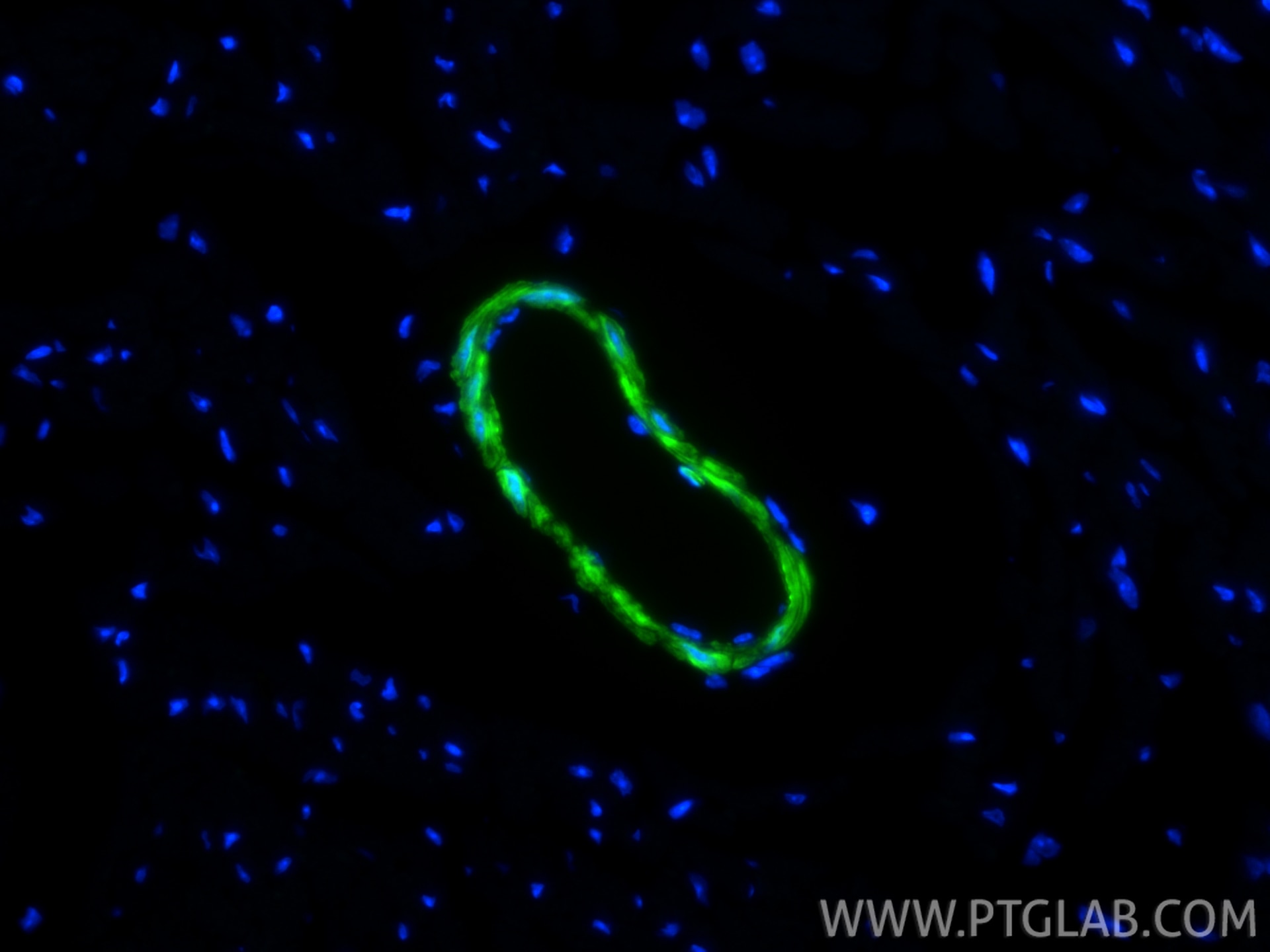 Immunofluorescence (IF) / fluorescent staining of mouse heart tissue using CoraLite® Plus 488-conjugated transgelin/SM22 Reco (CL488-83922-2)
