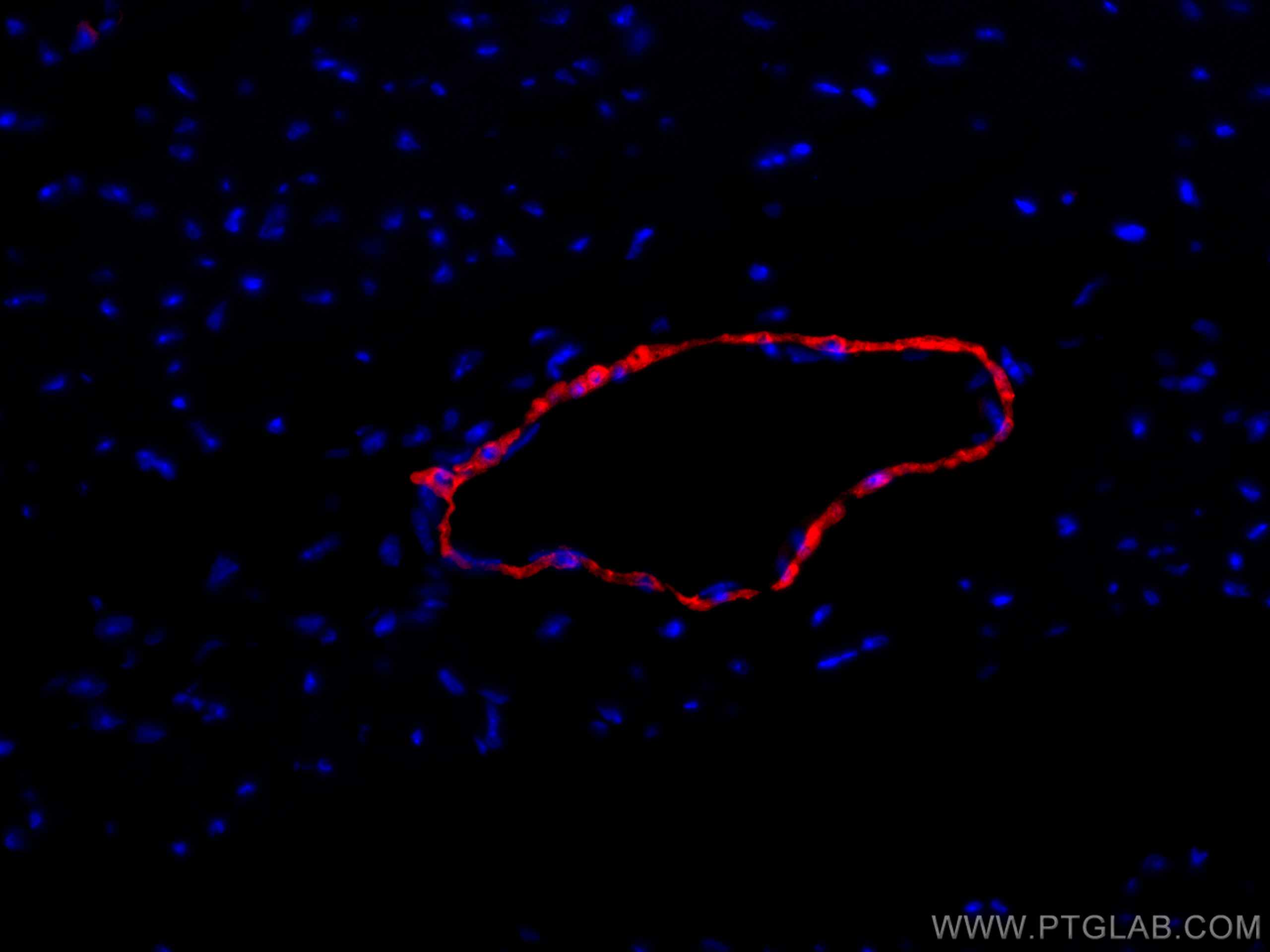 IF Staining of mouse heart using CL594-10493