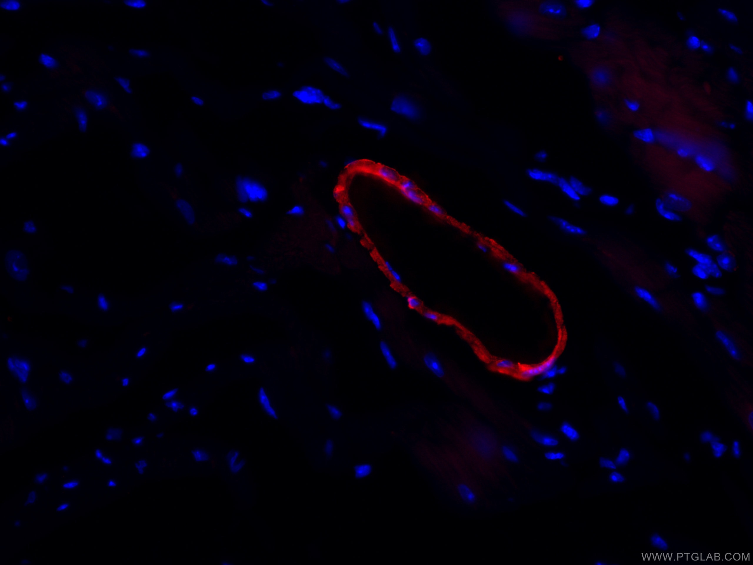 Immunofluorescence (IF) / fluorescent staining of mouse heart tissue using CoraLite®594-conjugated transgelin/SM22 Monoclonal (CL594-60213)