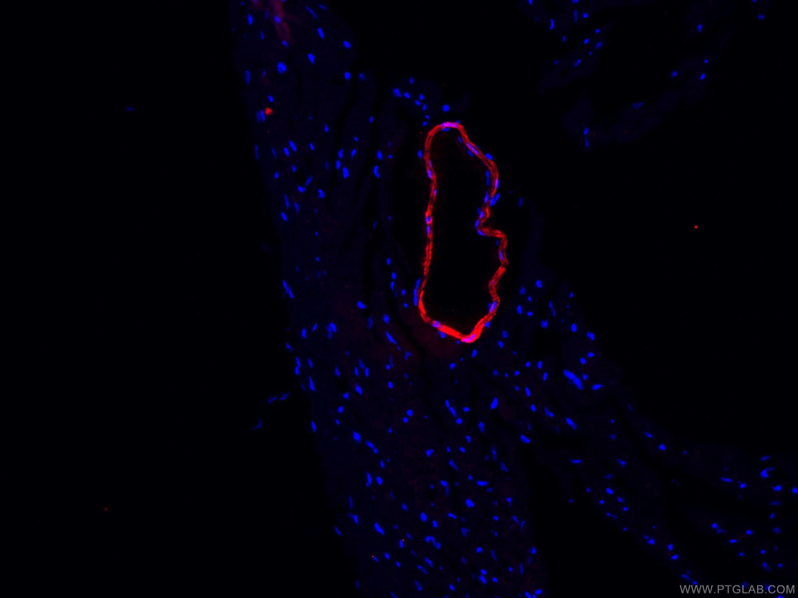 IF Staining of mouse heart using CL594-60213