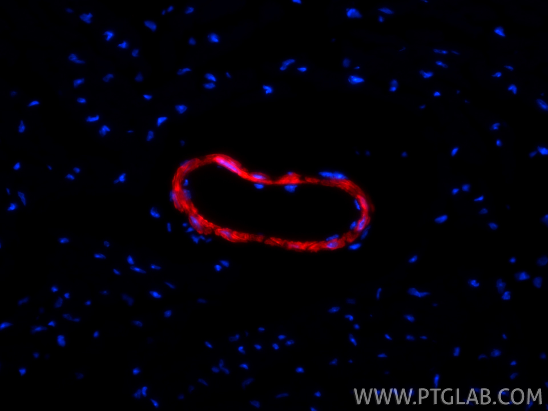 Immunofluorescence (IF) / fluorescent staining of mouse heart tissue using CoraLite®594-conjugated transgelin/SM22 Recombinan (CL594-83922-2)