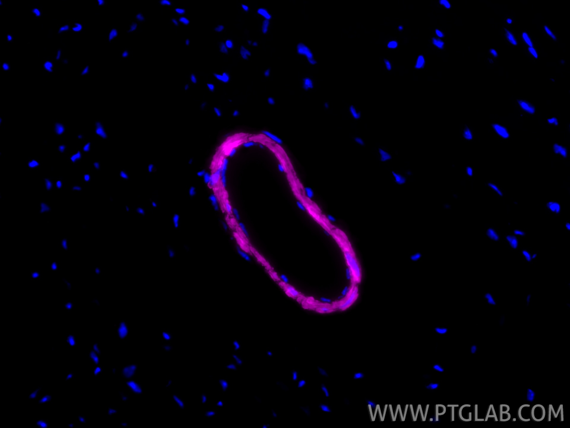 Immunofluorescence (IF) / fluorescent staining of mouse heart tissue using CoraLite® Plus 647-conjugated transgelin/SM22 Reco (CL647-83922-2)