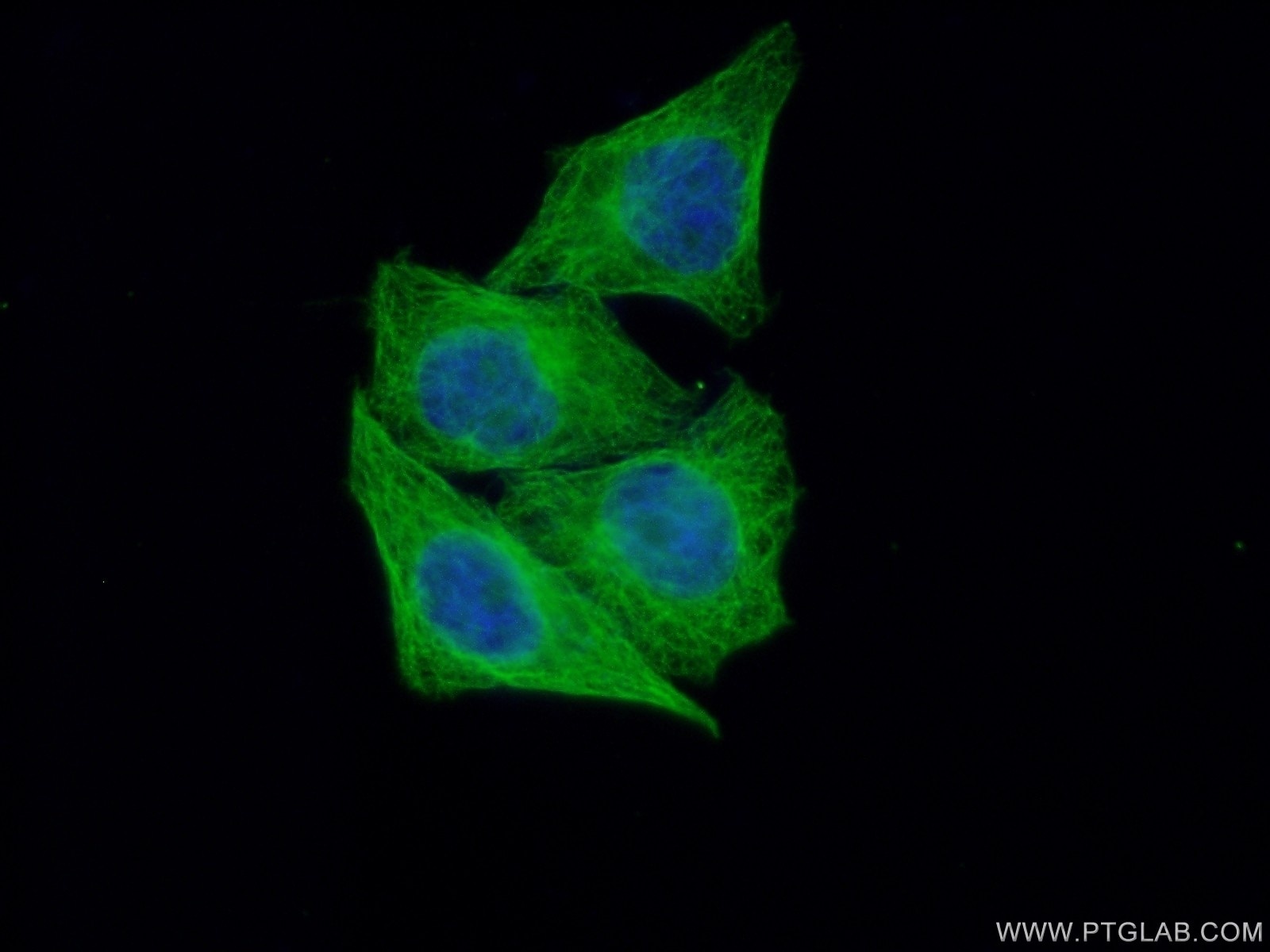 Alpha Tubulin Monoclonal antibody