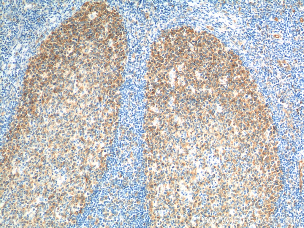 Immunohistochemistry (IHC) staining of human tonsillitis tissue using Alpha Tubulin Monoclonal antibody (66031-1-Ig)