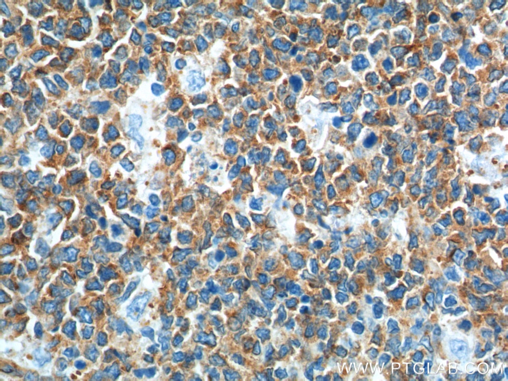 Immunohistochemistry (IHC) staining of human tonsillitis tissue using Alpha Tubulin Monoclonal antibody (66031-1-Ig)