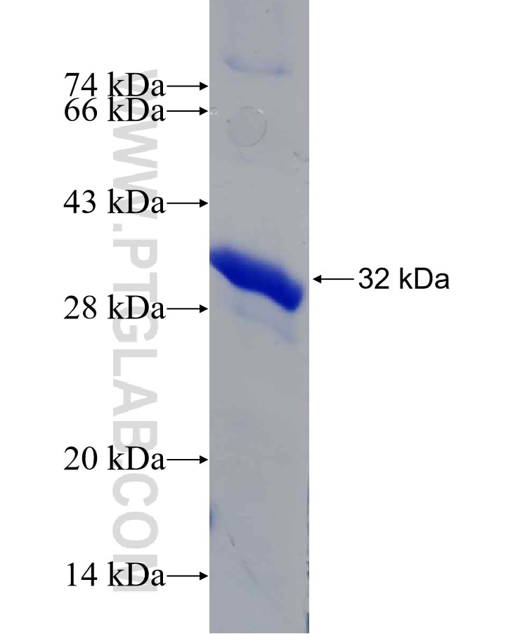 tubulin-beta fusion protein Ag19708 SDS-PAGE