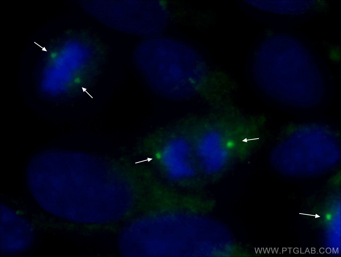 Immunofluorescence (IF) / fluorescent staining of MDCK cells using Gamma Tubulin Polyclonal antibody (26195-1-AP)