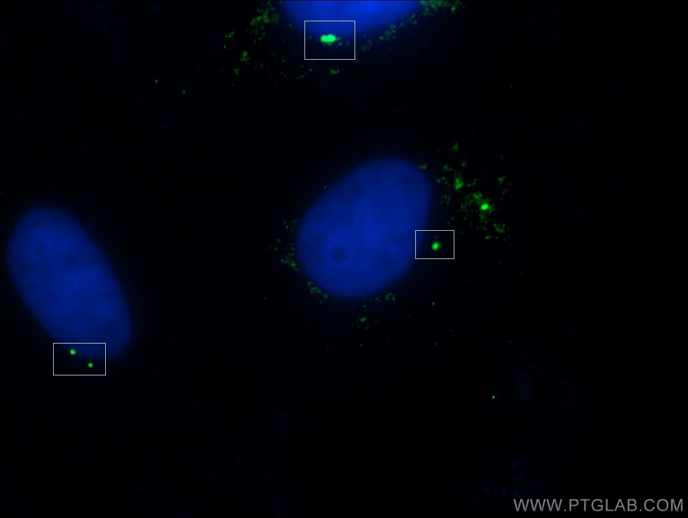 Immunofluorescence (IF) / fluorescent staining of MDCK cells using Gamma Tubulin Polyclonal antibody (26195-1-AP)