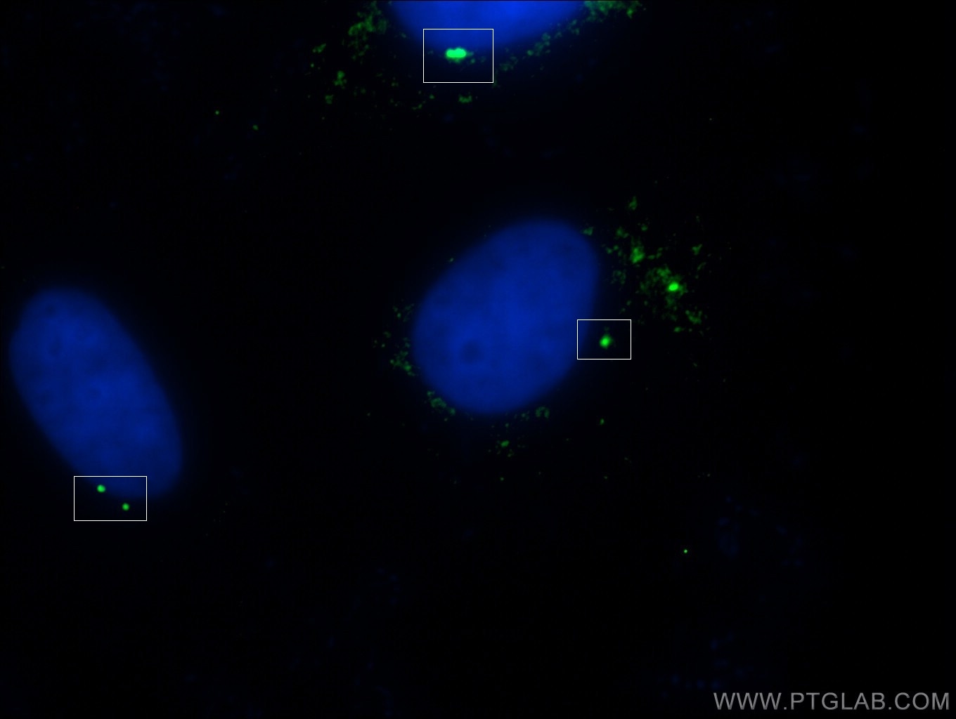 IF Staining of MDCK using 26195-1-AP