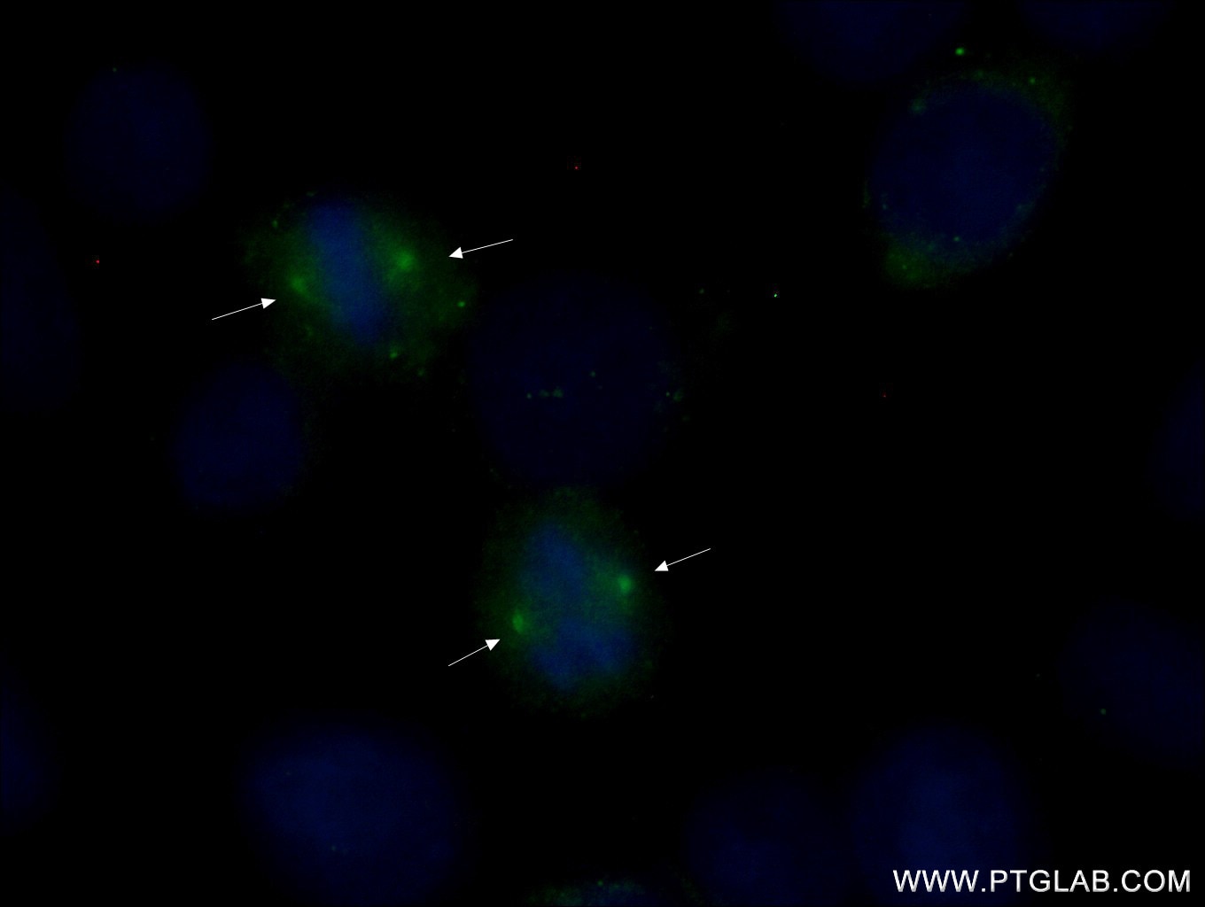 Immunofluorescence (IF) / fluorescent staining of HeLa cells using Gamma Tubulin Monoclonal antibody (66320-1-Ig)