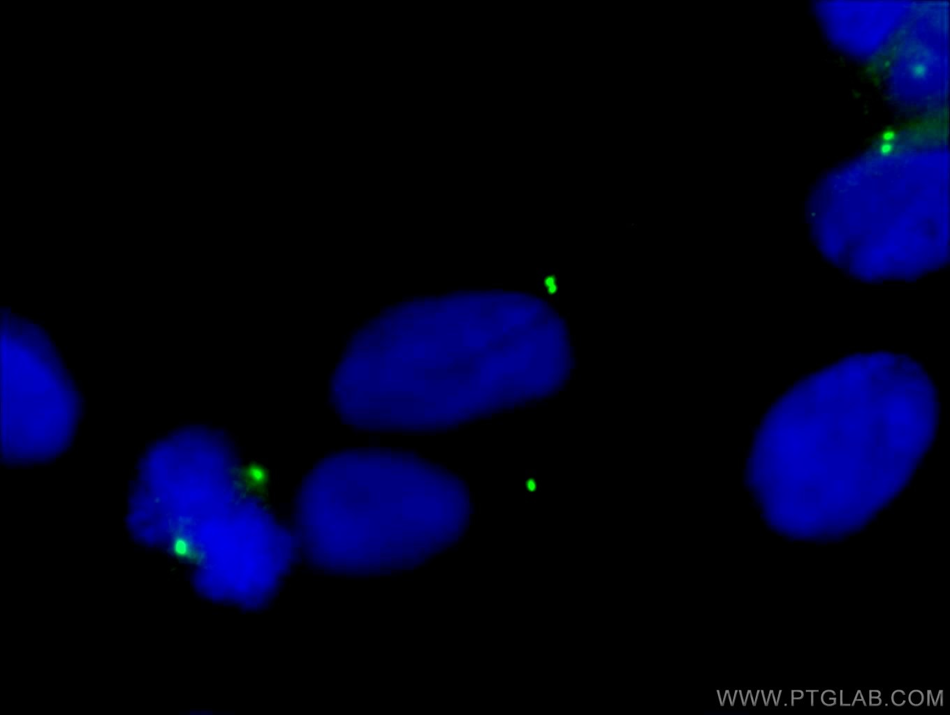 Immunofluorescence (IF) / fluorescent staining of MDCK cells using Gamma Tubulin Monoclonal antibody (66320-1-Ig)