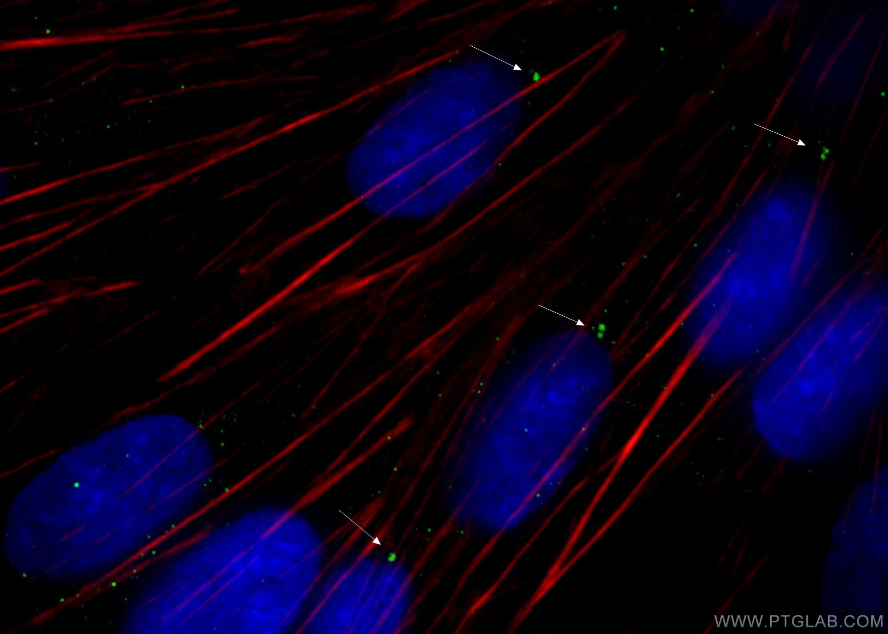 Immunofluorescence (IF) / fluorescent staining of MDCK cells using Gamma Tubulin Monoclonal antibody (66320-1-Ig)