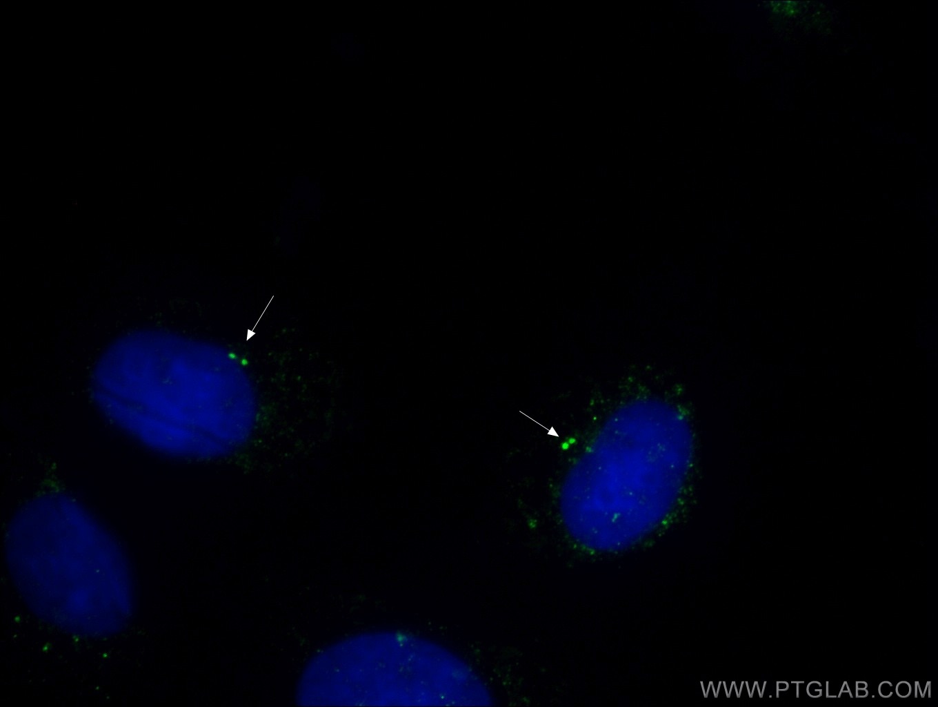 Gamma Tubulin Monoclonal antibody