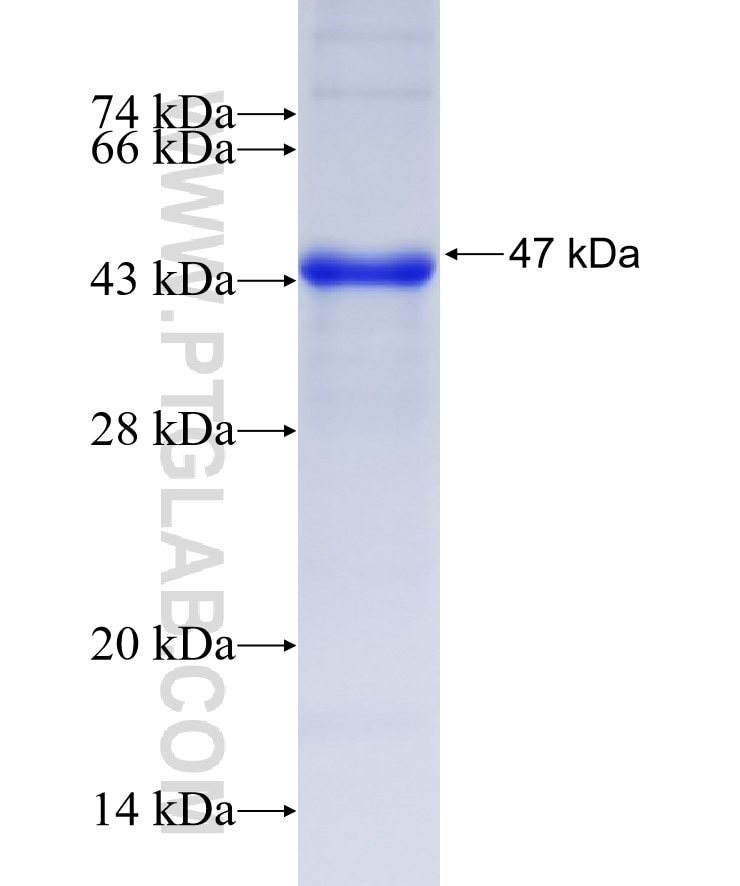 uPA fusion protein Ag30273 SDS-PAGE