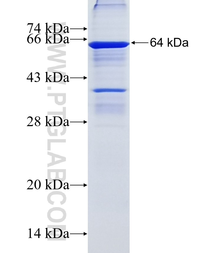 uPA fusion protein Ag11813 SDS-PAGE