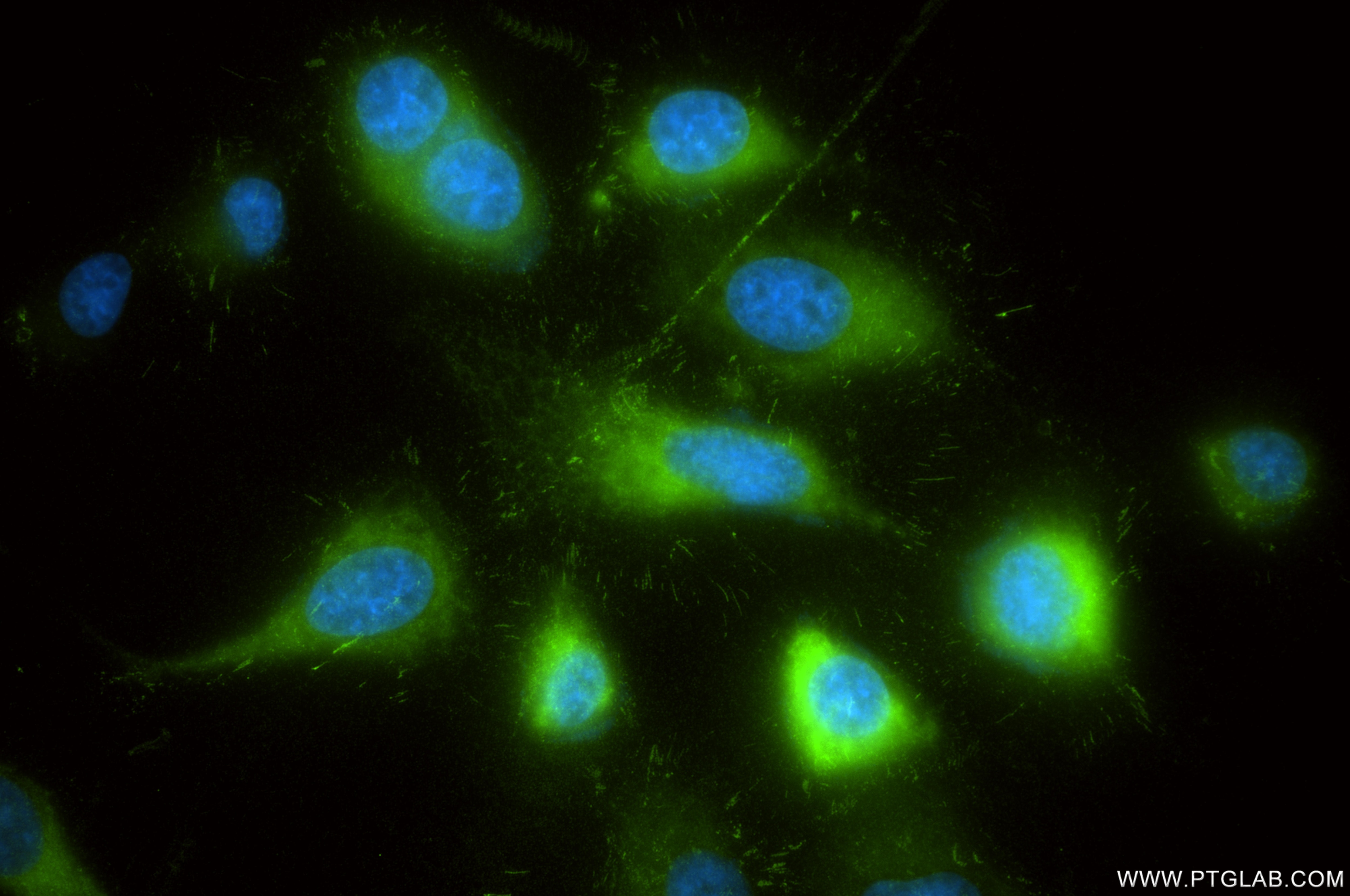 Immunofluorescence (IF) / fluorescent staining of PC-3 cells using uPA/Urokinase Recombinant monoclonal antibody (87458-1-RR)