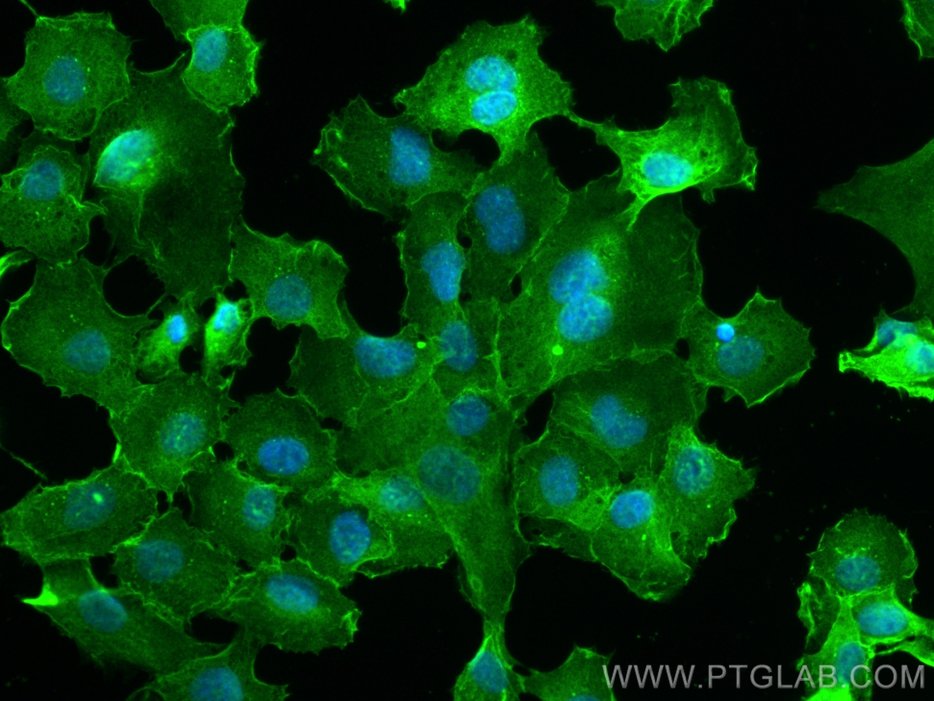 Immunofluorescence (IF) / fluorescent staining of HT-1080 cells using uPAR/CD87 Recombinant antibody (82953-1-RR)