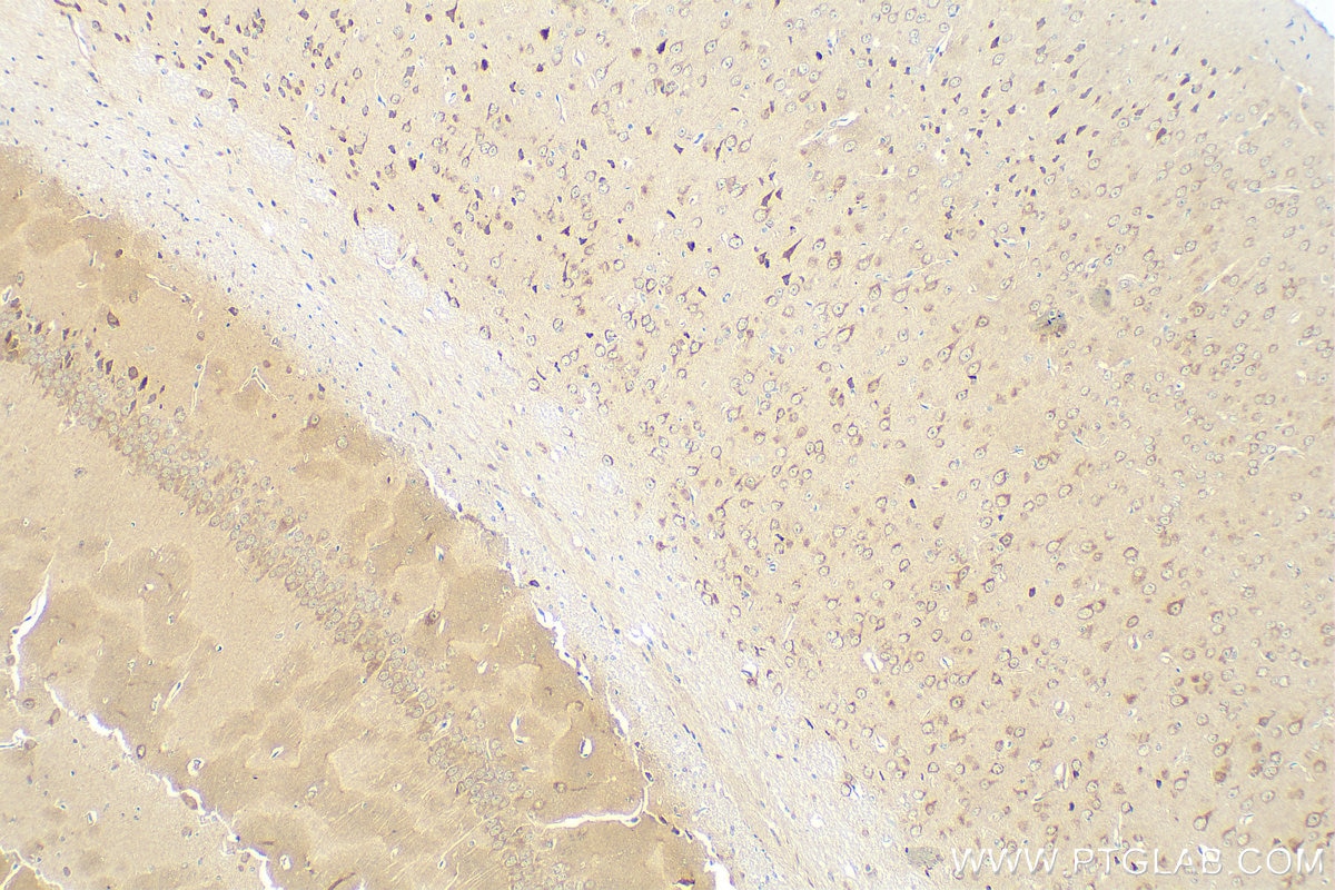 Immunohistochemistry (IHC) staining of mouse brain tissue using uPAR, PLAUR Recombinant antibody (82953-1-RR)
