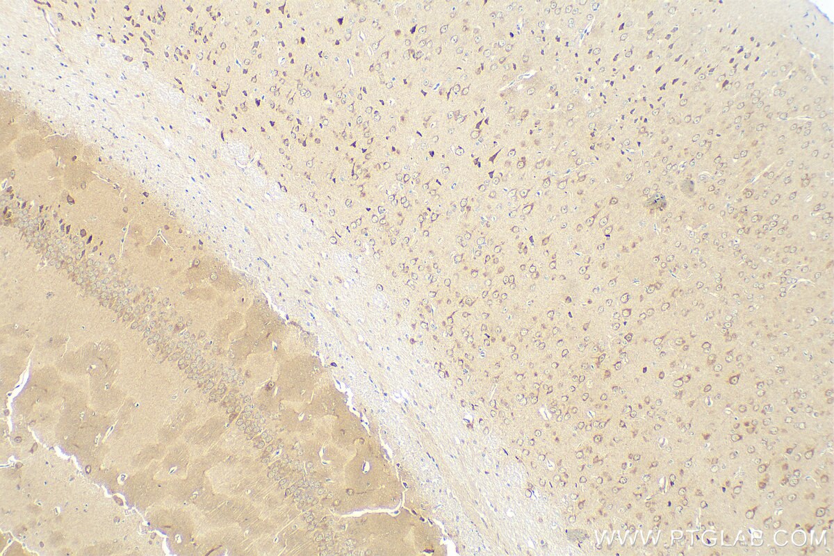 Immunohistochemistry (IHC) staining of mouse brain tissue using uPAR/CD87 Recombinant antibody (82953-1-RR)