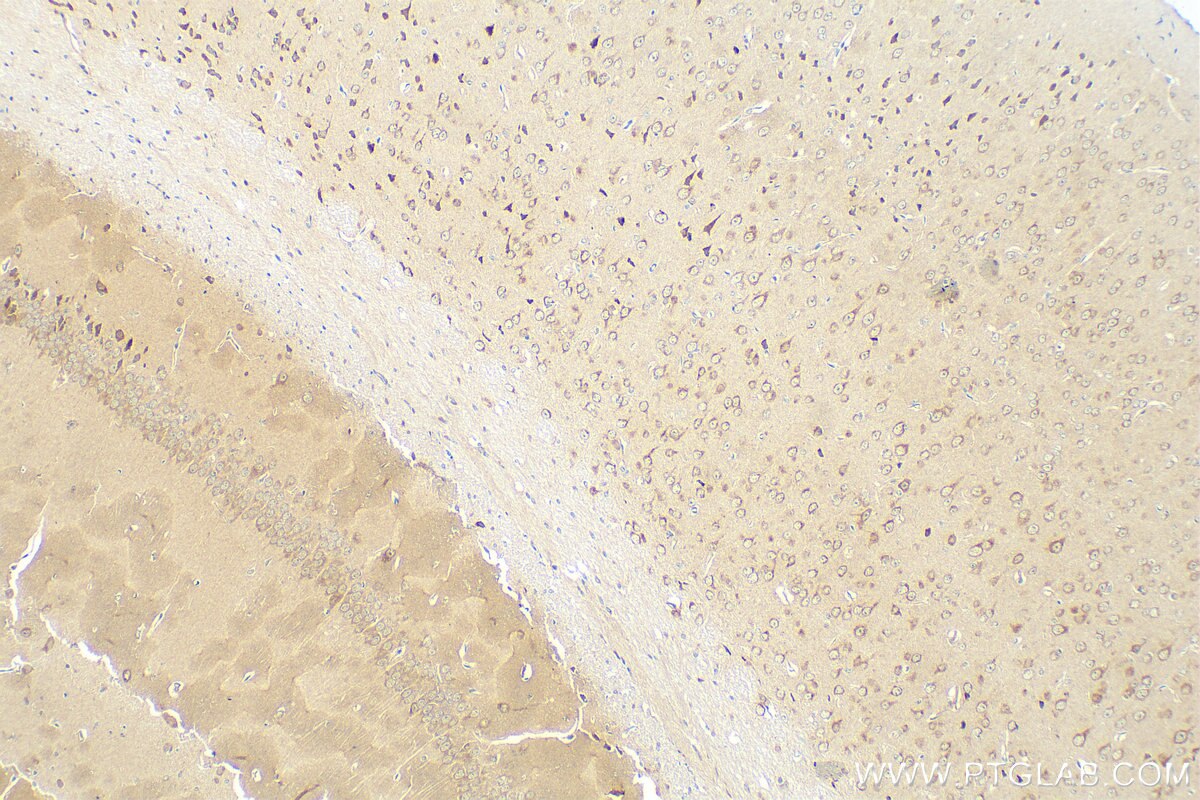 Immunohistochemistry (IHC) staining of mouse brain tissue using uPAR, PLAUR Recombinant antibody (82953-1-RR)