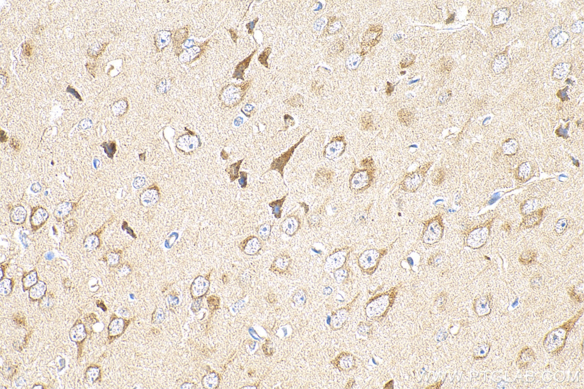 Immunohistochemistry (IHC) staining of mouse brain tissue using uPAR, PLAUR Recombinant antibody (82953-1-RR)