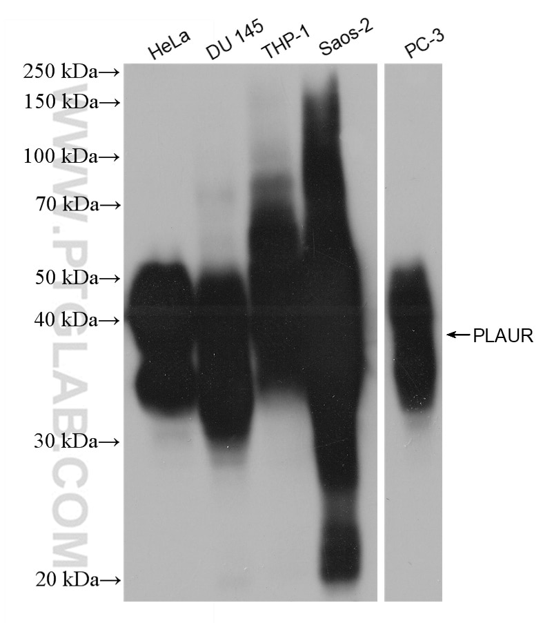 Western Blot (WB) analysis of various lysates using uPAR, PLAUR Recombinant antibody (82953-2-RR)