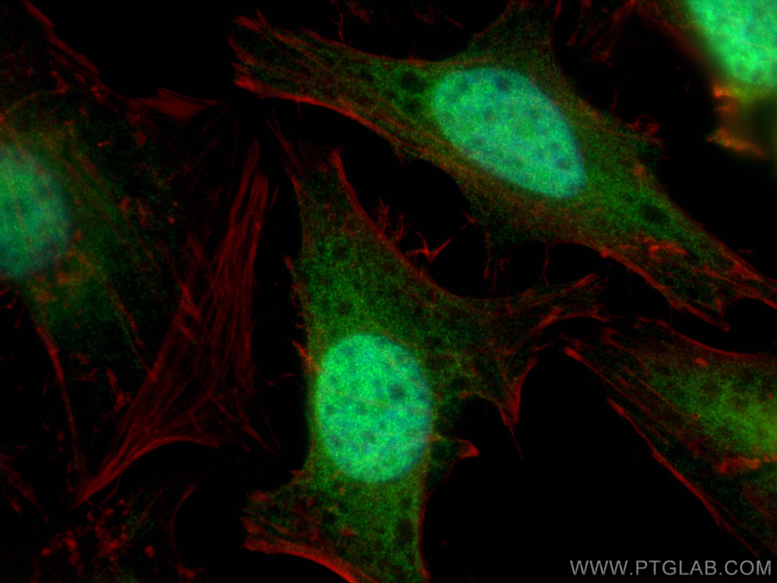 Immunofluorescence (IF) / fluorescent staining of HeLa cells using ubiquitin Polyclonal antibody (10201-2-AP)