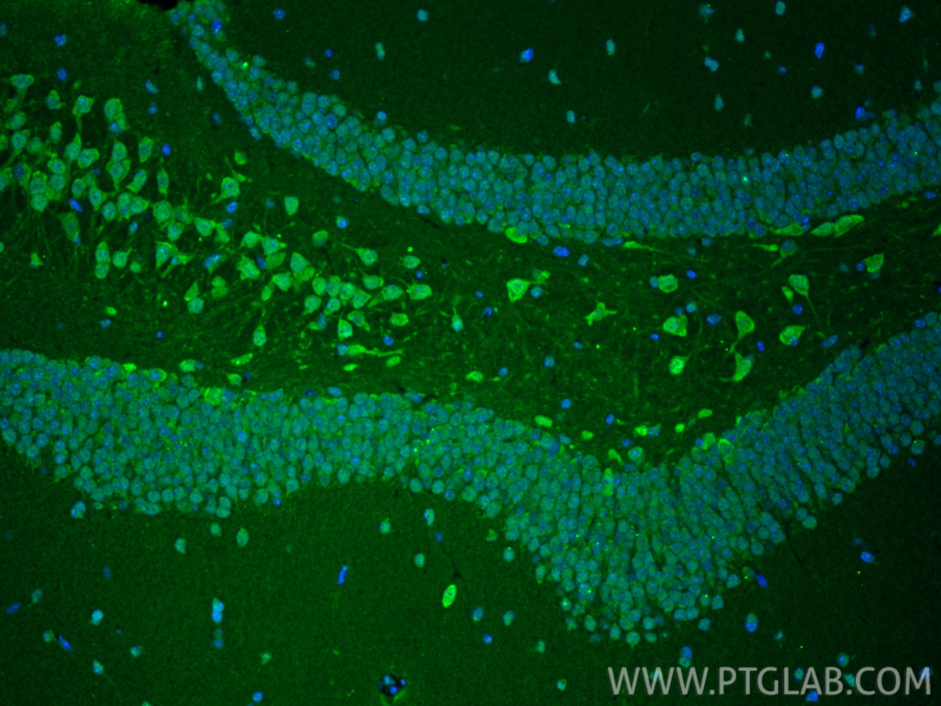 Immunofluorescence (IF) / fluorescent staining of mouse brain tissue using ubiquitin Polyclonal antibody (10201-2-AP)