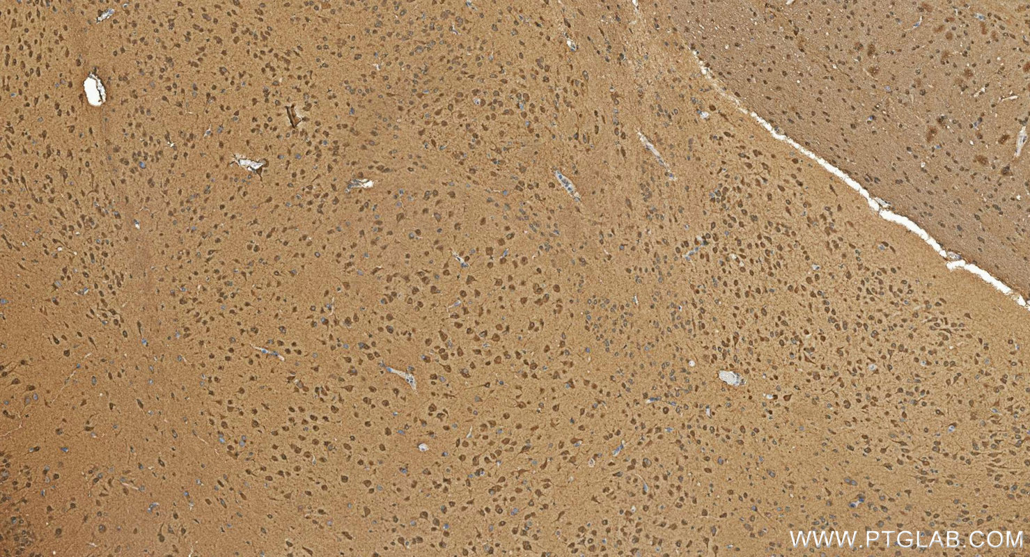 IHC staining of mouse brain using 10201-2-AP Immunohistochemistry (IHC) staining of mouse brain tissue using ubiquitin Polyclonal antibody (10201-2-AP)