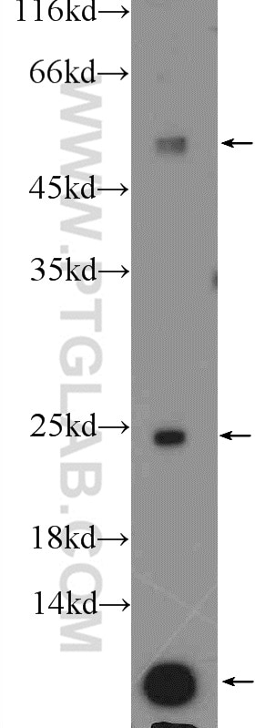Western Blot (WB) analysis of mouse liver tissue using ubiquitin Polyclonal antibody (10201-2-AP)