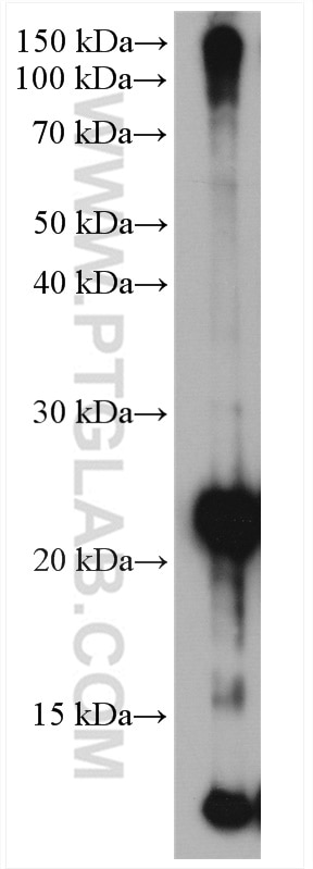 Western Blot (WB) analysis of MDA-MB-453s cells using ubiquitin Polyclonal antibody (10201-2-AP)