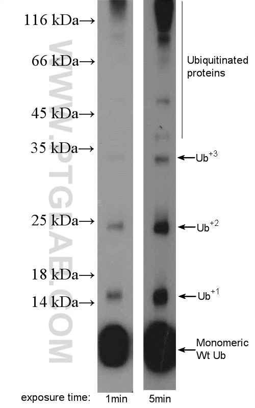 Western Blot (WB) analysis of MDA-MB-453s cells using ubiquitin Polyclonal antibody (10201-2-AP)