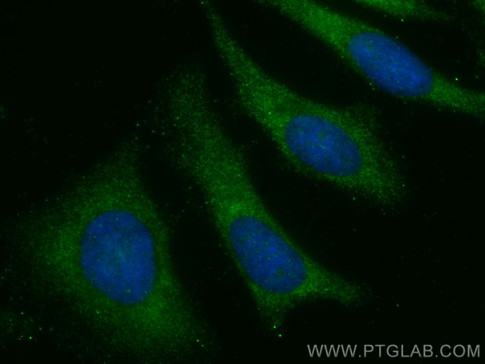 Immunofluorescence (IF) / fluorescent staining of HeLa cells using RPS27A Polyclonal antibody (14946-1-AP)