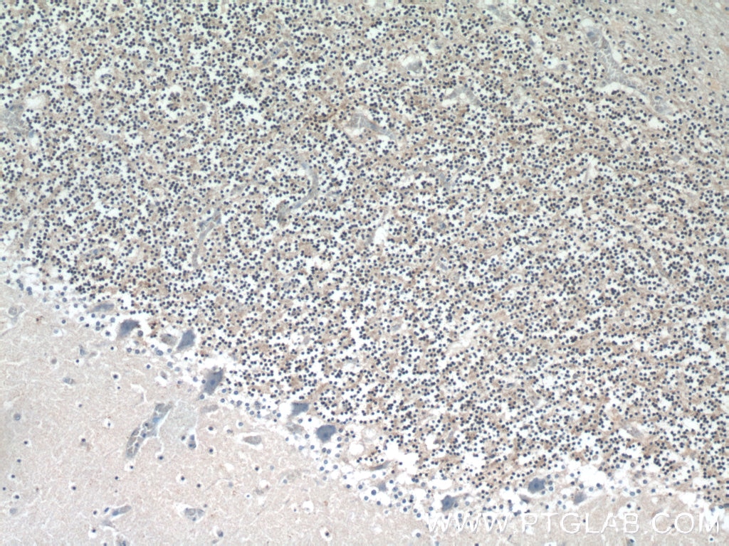 IHC staining of human cerebellum using 14946-1-AP