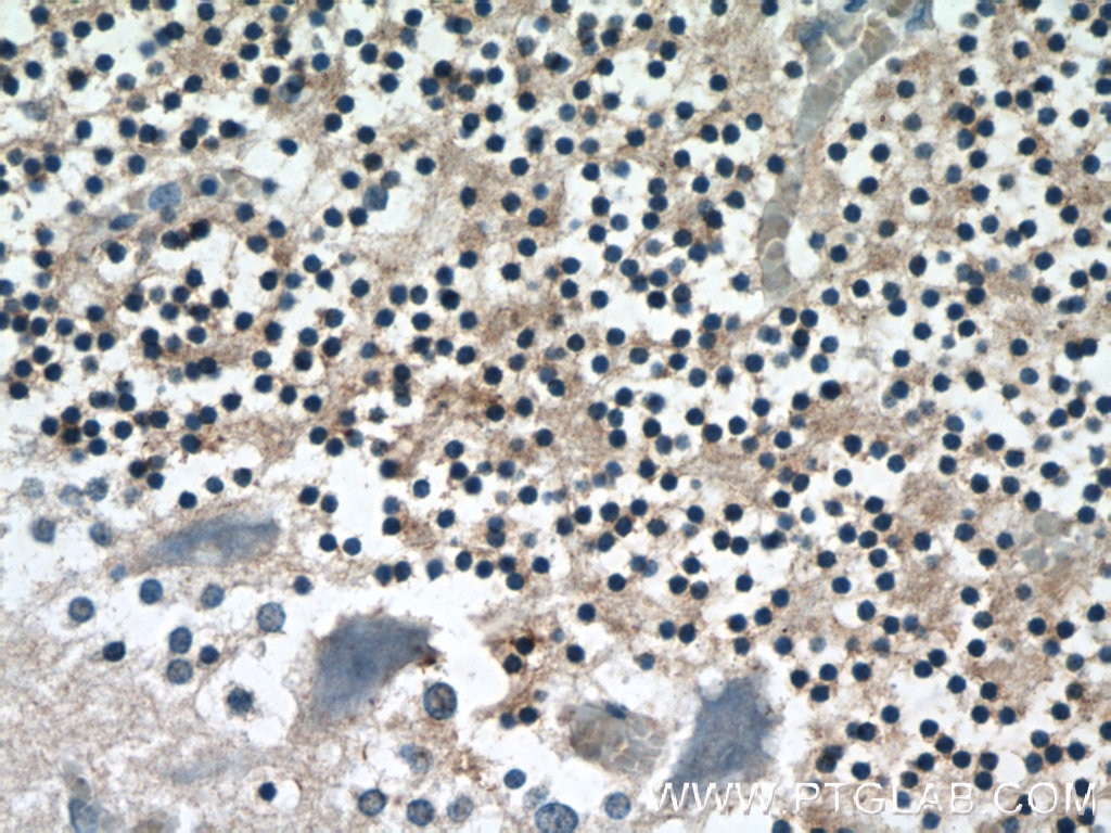 Immunohistochemistry (IHC) staining of human cerebellum tissue using RPS27A Polyclonal antibody (14946-1-AP)