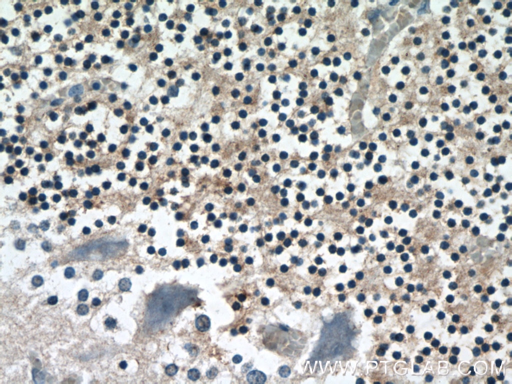 IHC staining of human cerebellum using 14946-1-AP