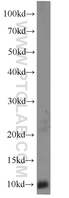 Western Blot (WB) analysis of Jurkat cells using RPS27A Polyclonal antibody (14946-1-AP)