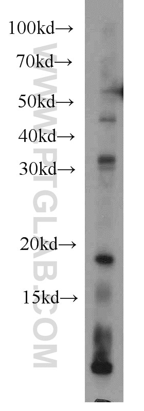 Western Blot (WB) analysis of mouse cerebellum tissue using RPS27A Polyclonal antibody (14946-1-AP)
