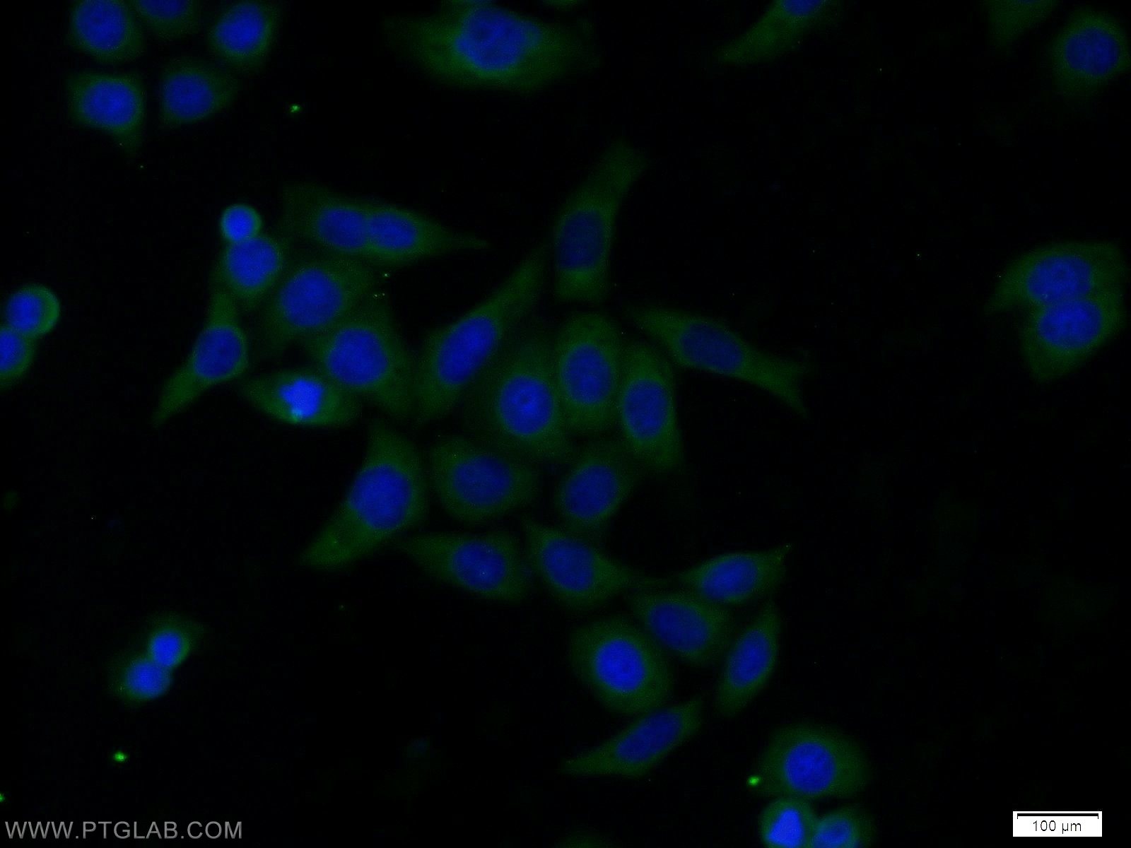 Immunofluorescence (IF) / fluorescent staining of HeLa cells using ubiquitin Monoclonal antibody (60310-1-Ig)