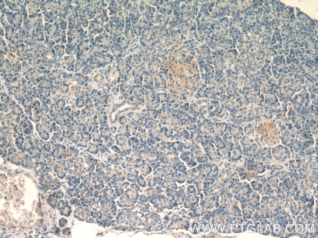 IHC staining of human pancreas using 60310-1-Ig