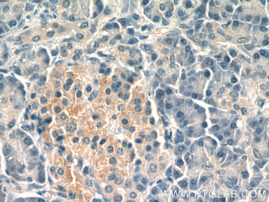 IHC staining of human pancreas using 60310-1-Ig