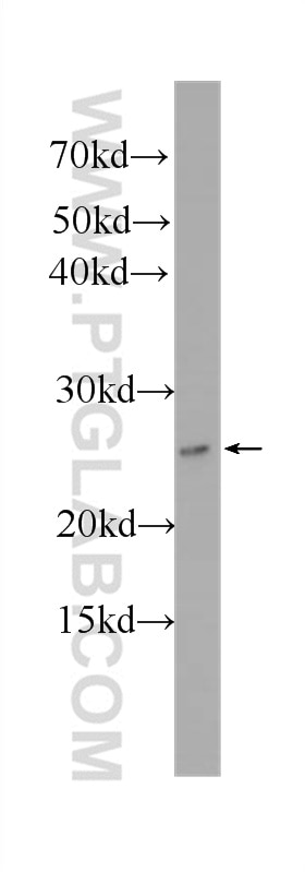 Western Blot (WB) analysis of HeLa cells using ubiquitin Monoclonal antibody (60310-1-Ig)